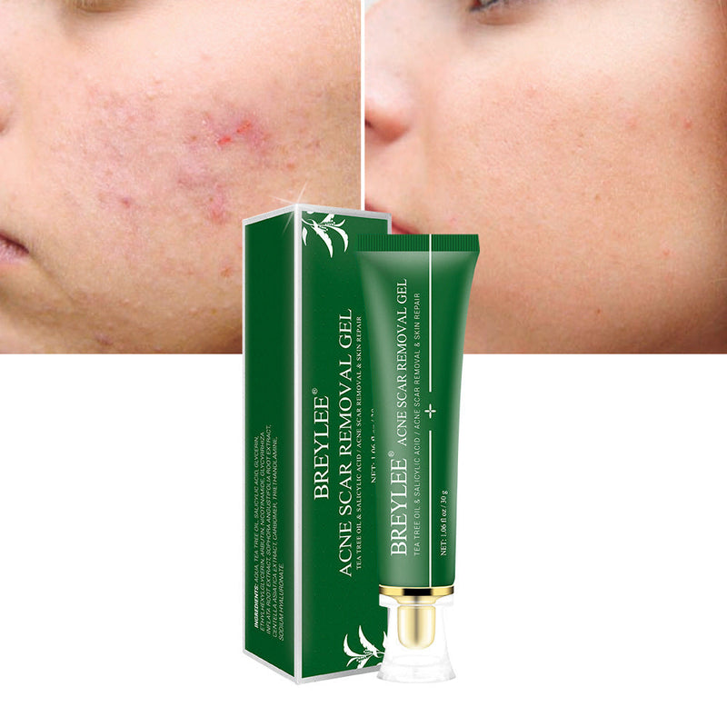 Acne Scar Removal Gel