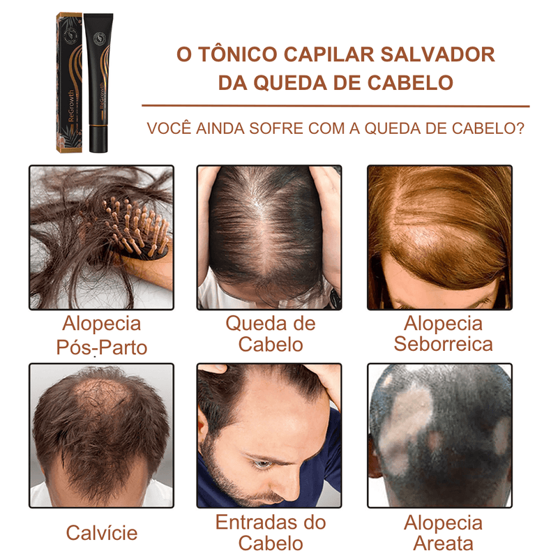 Tônico Capilar Serum Roller Eelhoe Original - Crescimento e Volume dos Fios - Combate a Queda de Cabelo