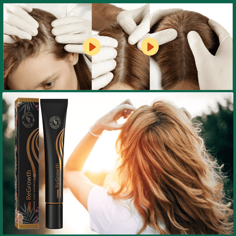 Tônico Capilar Serum Roller Eelhoe Original - Crescimento e Volume dos Fios - Combate a Queda de Cabelo