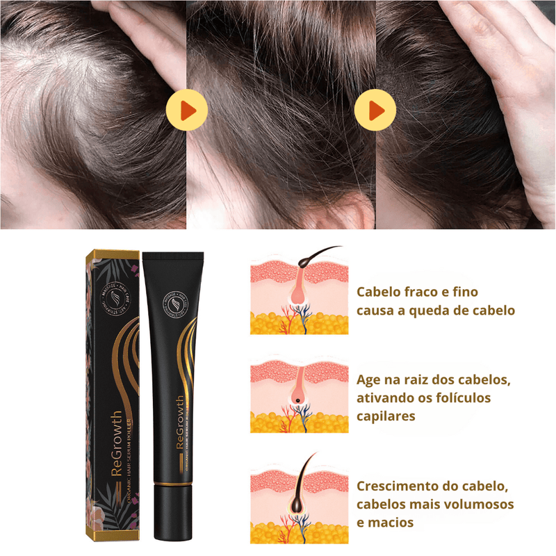 Tônico Capilar Serum Roller Eelhoe Original - Crescimento e Volume dos Fios - Combate a Queda de Cabelo